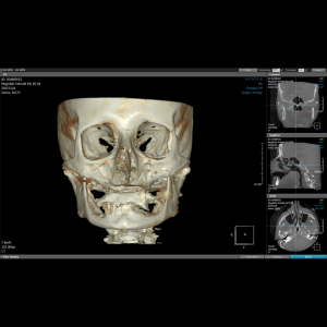 מכשיר סיטי CBCT משולב פנורמי Dentri